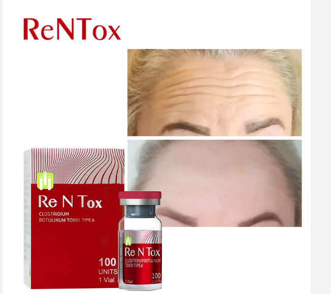 rentox