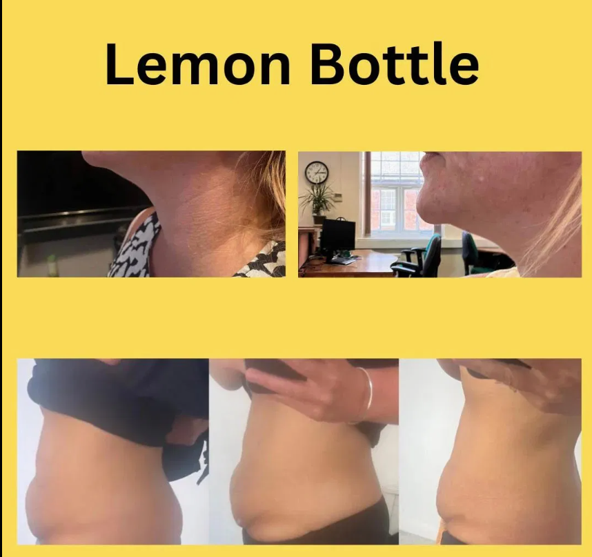 lemon bottle1