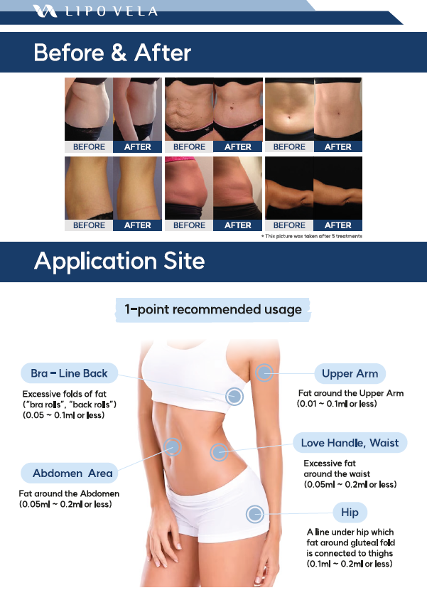 Lipo Vela Lipolysis