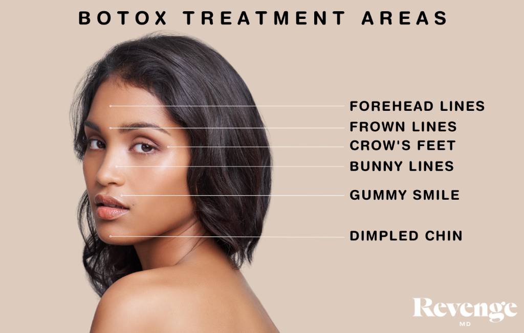 Botox Before and After: Exploring Popular Treatment - Revenge MD