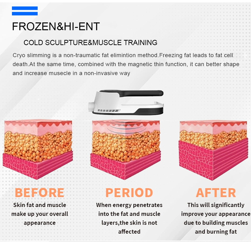 Newest Technology Cryolipolysis &EMS Slim EMS Sculpt Beauty Machine for Aesthetic Salon