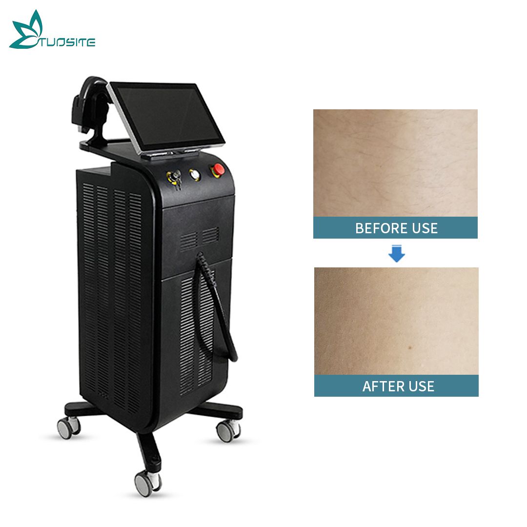 808nm Diode Laser Machine Diode Laser Hair Removal Beauty Equipment