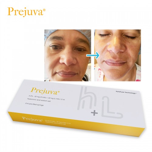 Prejuva Buy Hyaluronic Acid H L 64mg Dermal Filler Product for Face Lift