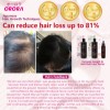 Advance Biotin and Hair Growth Scalp Serum