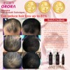 Advance Biotin and Hair Growth Scalp Serum