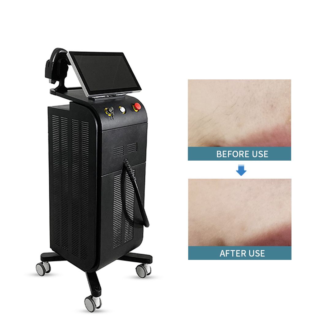 New Wavelength 755 808 1064 Laser Hair Removal Diode Laser Hair Removal 808