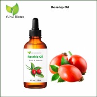 Best Manufacturer Rosehip Oil for Acne Scars After Surgery