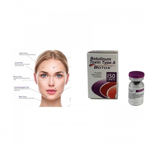 BOTOX 100 Allergan Units Powder for solution for injection