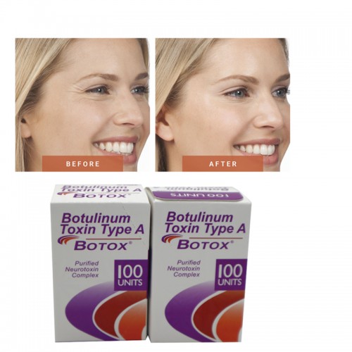 BOTOX 100 Allergan Units Powder for solution for injection