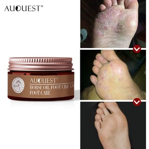 Foot Defrosting Remove Dead Skin Foot Cream for Peeling Cuticles Heel Skin  Care - Guangzhou Bonnieco Cosmetics Co., Ltd.