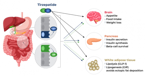 effective Semaglutide Tirzepatide Ipamorelin the newest injectable medication for the treatment of adults with obesity