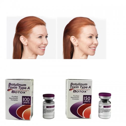 Botox Allergan Cosmetic Botulinum Toxin Type A