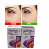 Botox Allergan Cosmetic Botulinum Toxin Type A